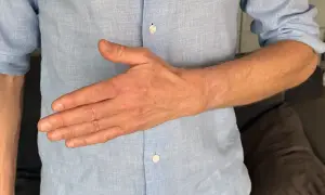 En man i ljusblå skjorta visar sin ont ovansida hand.
