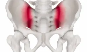 Skelettet visar bäckenet med markerad smärta i höftlederna, vilket kan vara relaterat till foglossning rumpa.