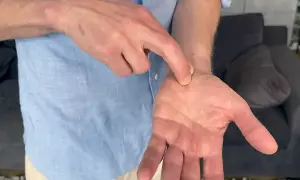 En man pekar på sin handled, som om han har ont i handled och fingrar.