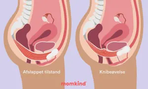 Bilder visar bäckenbottenmuskulaturen. Vart sitter blygdbenet gravid? Det sitter framtill i bäckenet, under urinblåsan.