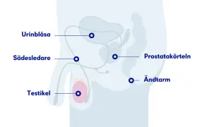 Anatomisk illustration visar urinblåsa, sädesledare, testikel, prostatakörteln och ändtarm. Kan vara relevant vid ont i pungen och ljumsken.