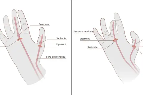 Illustrationer visar handens olika delar: senor, senskidor, ligament och senknutor.