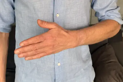 En man i ljusblå skjorta visar sin ont ovansida hand.