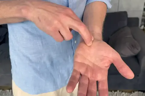 En man pekar på sin handled, som om han har ont i handled och fingrar.