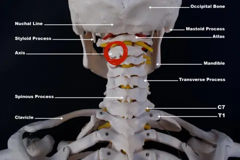 Modell av halsryggen med atlas och axis markerade. C7 och T1 syns längst ner.