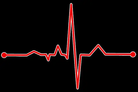 Rött EKG-streck på svart bakgrund, symboliserar en kvinnas maxpuls.