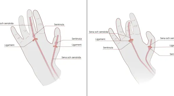 Illustrationer visar handens olika delar: senor, senskidor, ligament och senknutor.
