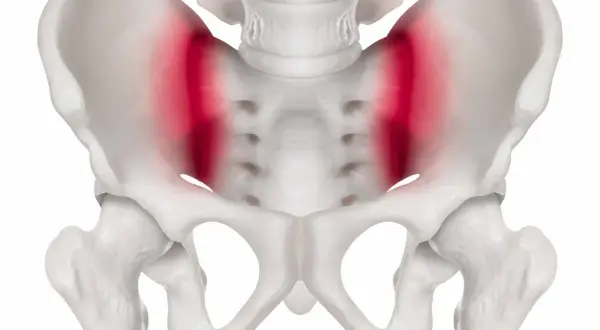Skelettet visar bäckenet med markerad smärta i höftlederna, vilket kan vara relaterat till foglossning rumpa.