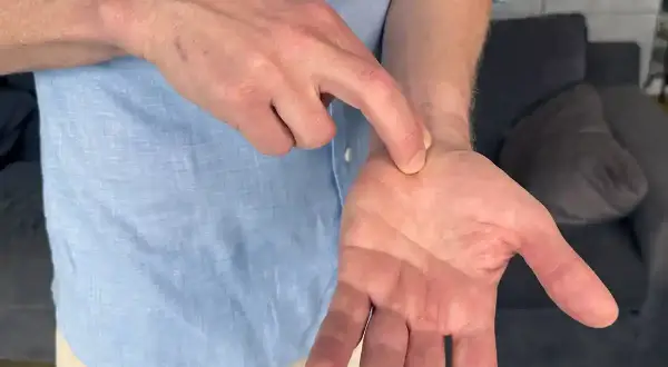 En man pekar på sin handled, som om han har ont i handled och fingrar.