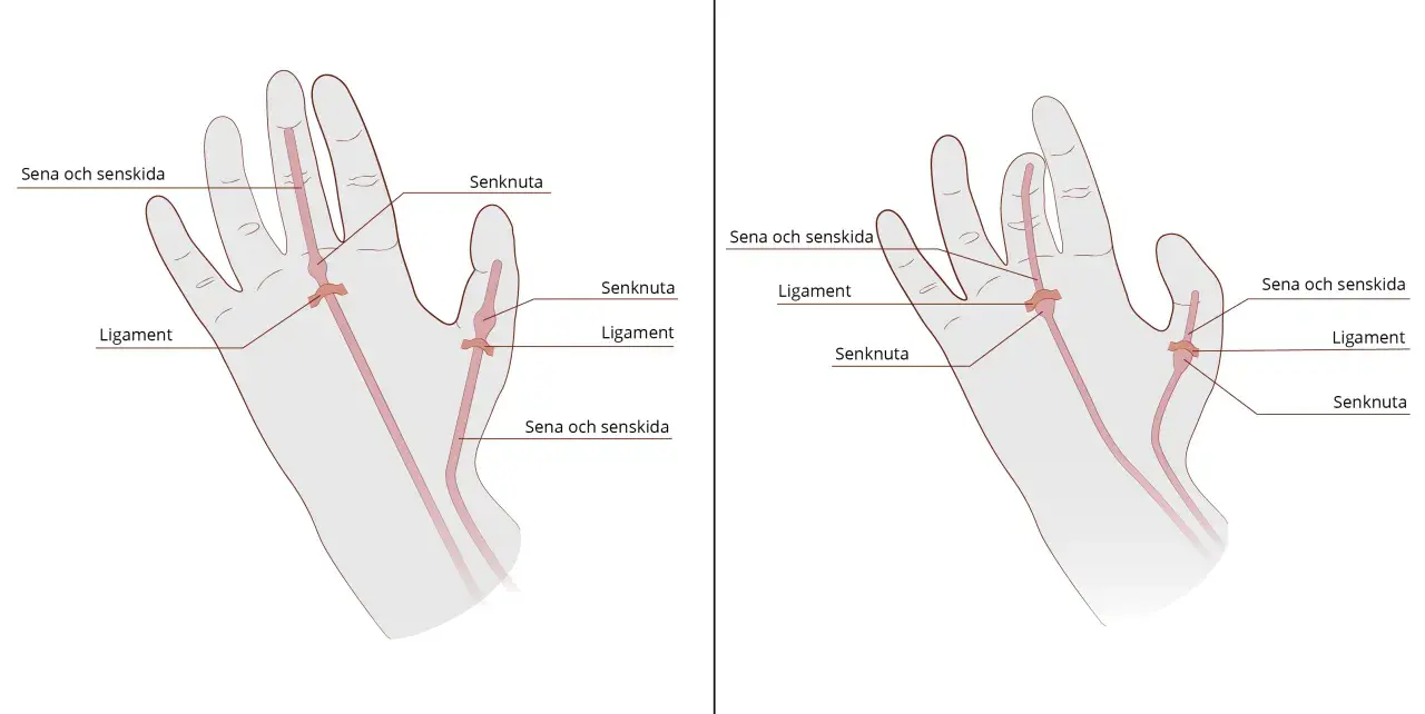 Illustrationer visar handens olika delar: senor, senskidor, ligament och senknutor.