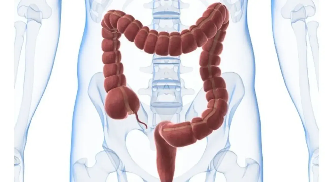 En illustration av tjocktarmen, med dess segmenterade utseende. Kan vara relevant vid undersökning av psoas tecken.