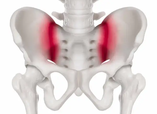 Skelettet visar bäckenet med markerad smärta i höftlederna, vilket kan vara relaterat till foglossning rumpa.